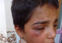 ضرب و جرح شدید دو کودک بلوچ؛ منابع، عامل این خشونت را پدر آنان معرفی میکنند